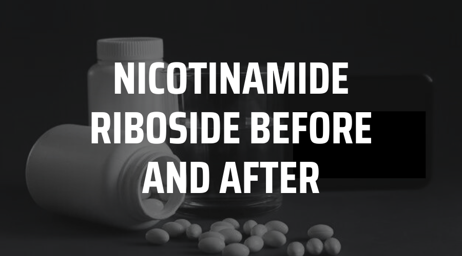 Nicotinamide Riboside Before and After